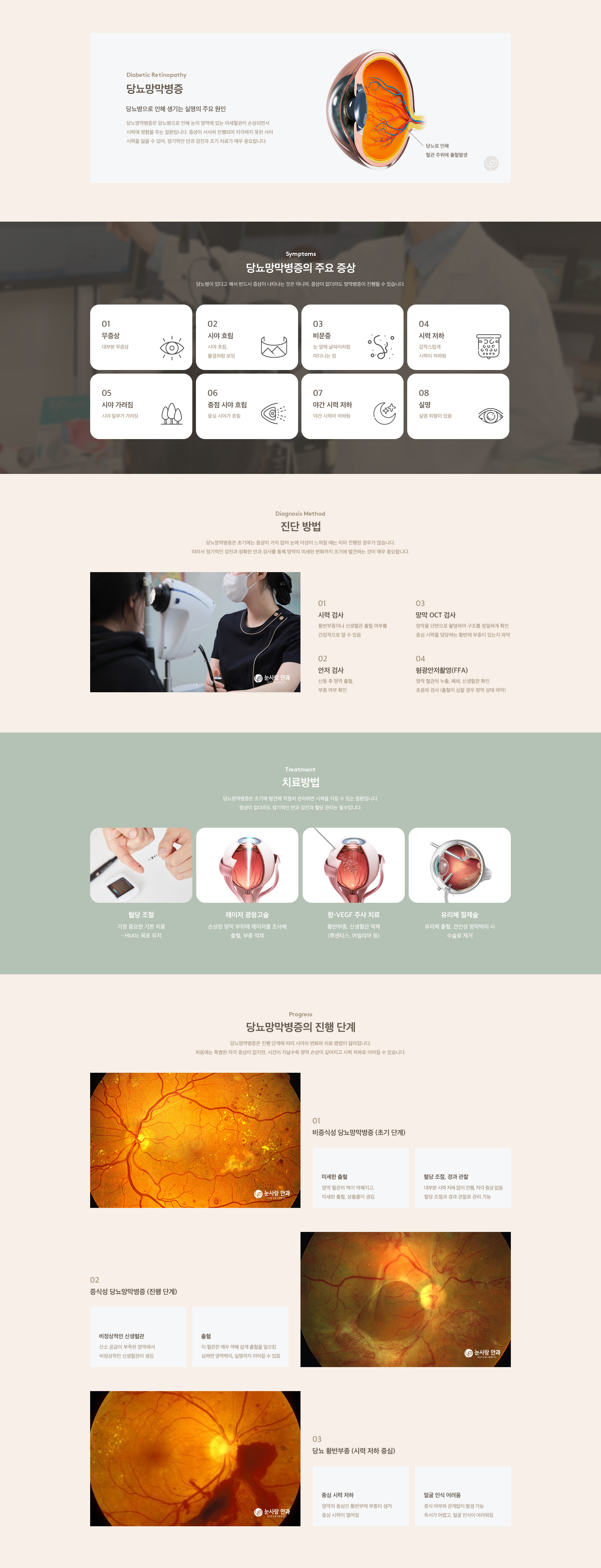 당뇨망막병증