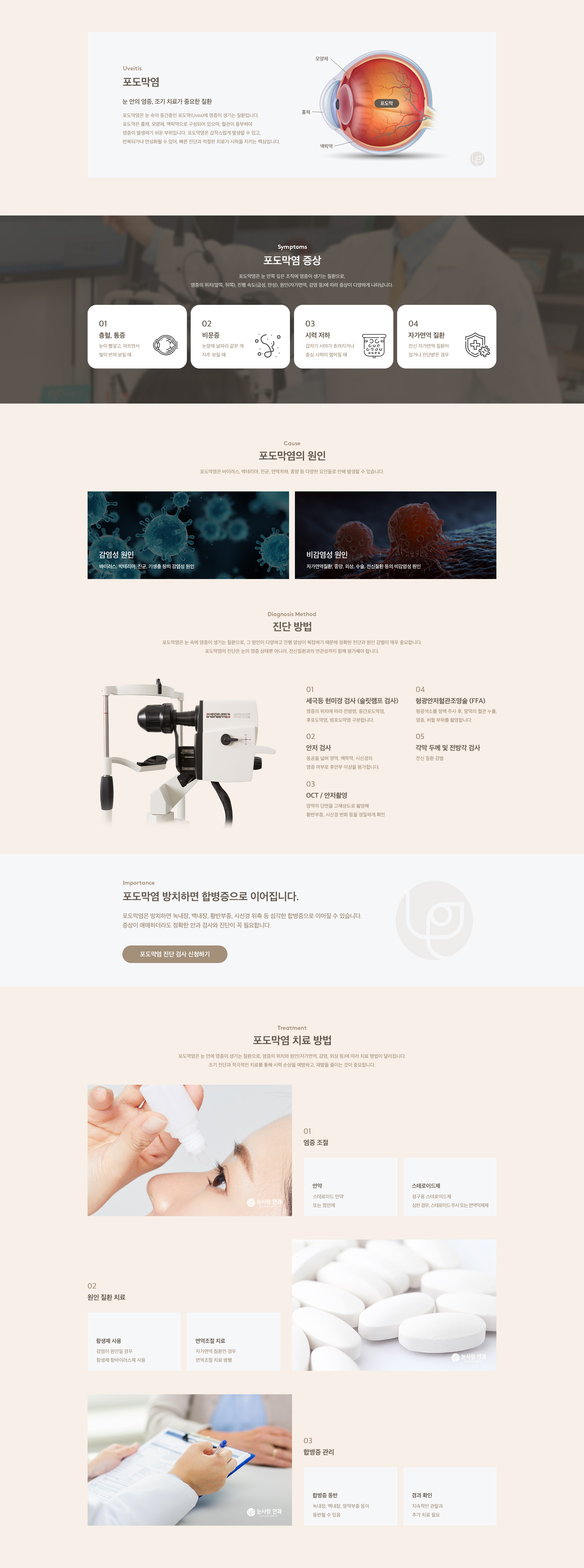포도막염