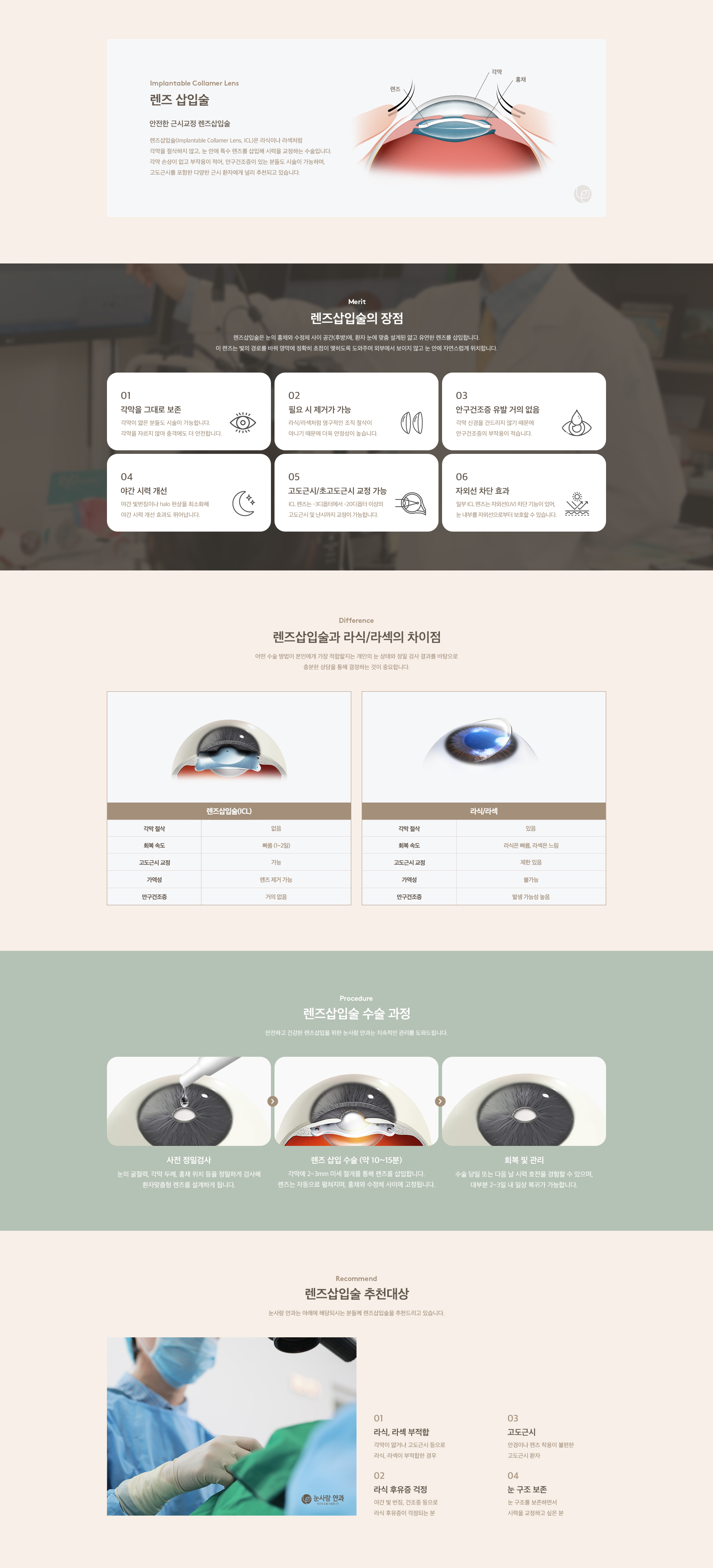 렌즈삽입술