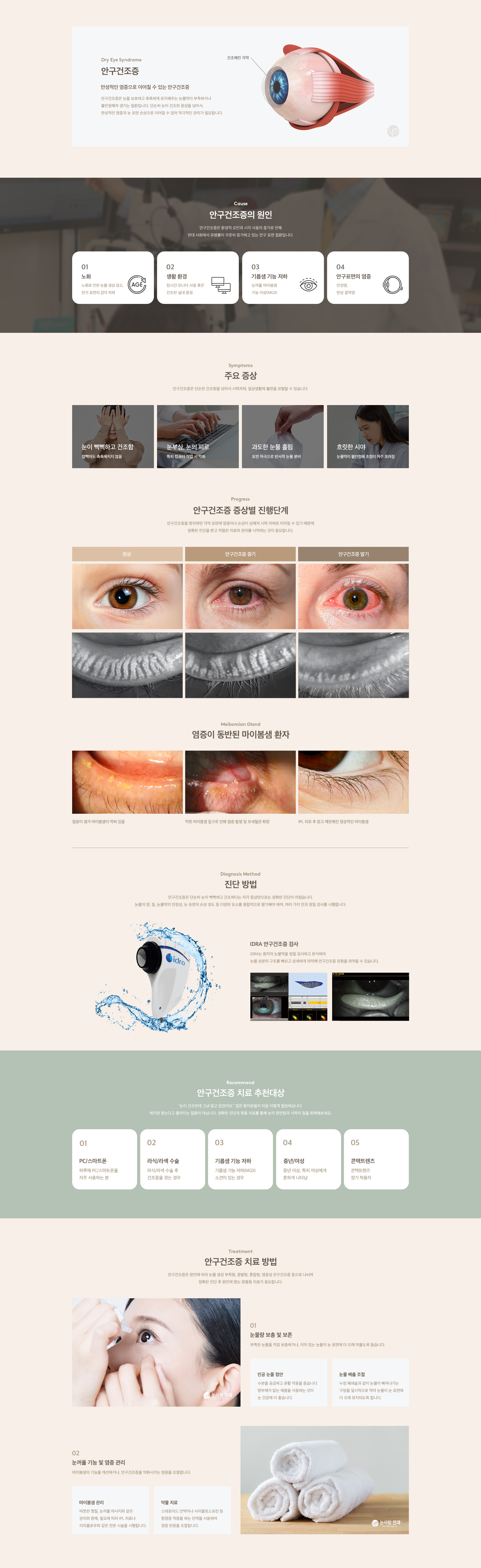 안구건조증